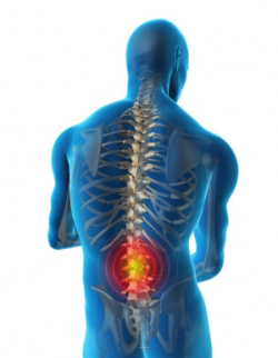 Il mal di schiena dovuto ad ernia a disco